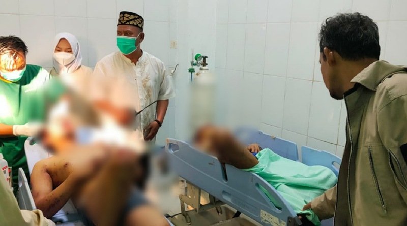 Hendak Curanmor Kedua Pelaku Nyaris Tewas Dihakimi Massa di Purwakarta