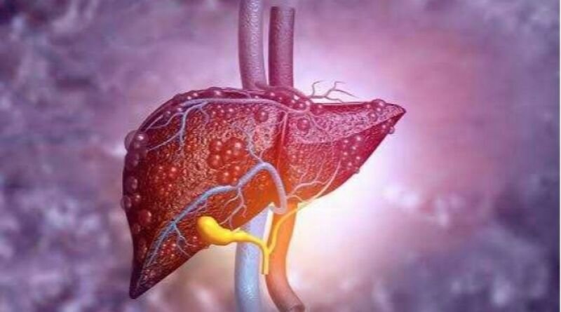 Dokter Jelaskan Tidak Benar Hepatitis Akut Berhubungan dengan Vaksin Covid-19
