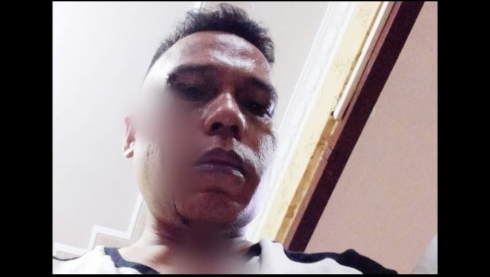 Polisi Diminta Menangkap Pelakunya, Mantan Ketua PWI Lamandau Jadi Korban Penganiayaan