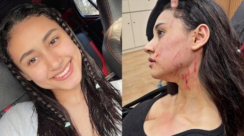 Kejam! Selebgram Afifah Riyad Diserang Mantan Pacar Suaminya, Netizen: Suaminya Diam Aja?