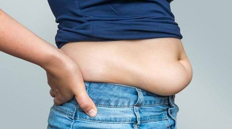 Sedot Lemak Bukan Solusi Cepat untuk Langsing: Fakta Penting dari Ahli Bedah Plastik