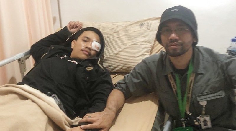 Dekan FISIP Unibba Rendy Adiwilaga Laporkan Kondisi Andi Andriana di RS Cicendo