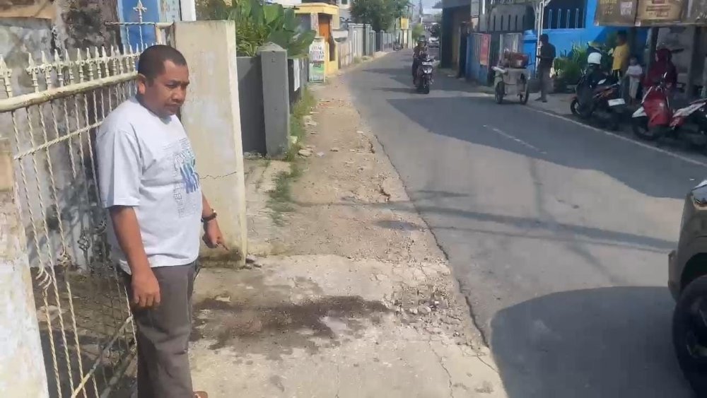 Begini Kondisi Ibu dan Anak Korban Penyiraman Air Keras di Sukabumi