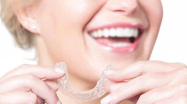 Material "Multilayer Clear Aligner" Telah Dilansir: Tristar buatan Whitesmile Clear