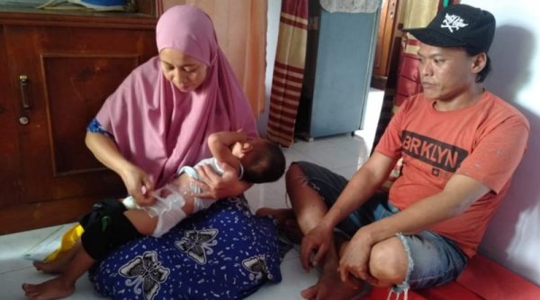 Balita di Sidoarjo Tidak Punya Lubang Anus Butuh Bantuan, Dua Tahun Menunggu Operasi