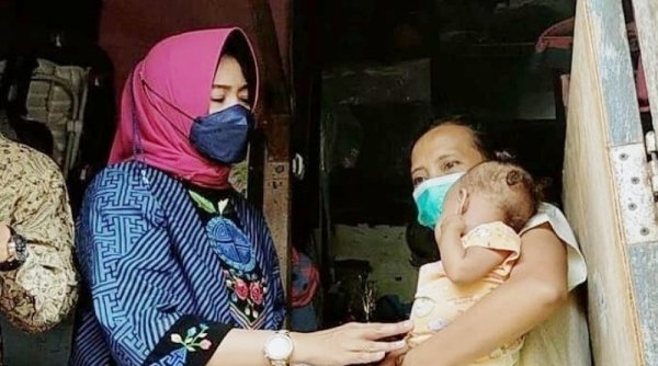 Bayi Berkelamin Ganda di Surabaya Mendapat Perhatian dari Kepala Dinsos