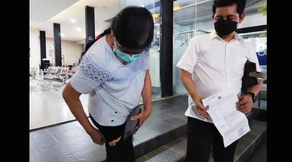 Korban Gigitan Anjing Herder, Laporkan Tetangganya ke Polisi