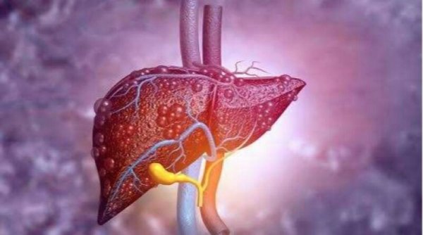 Dokter Jelaskan Tidak Benar Hepatitis Akut Berhubungan dengan Vaksin Covid-19