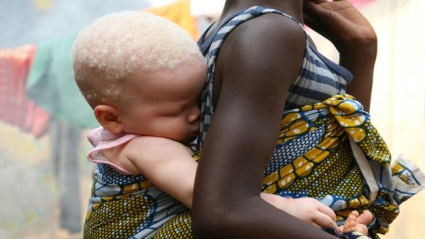 14 Tewas 28 Luka Ditembak Polisi Saat Amankan Pengunjuk Rasa dalam Kasus Penculikan Anak Albino