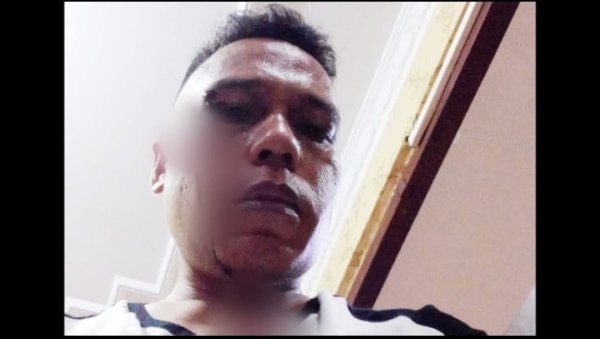 Polisi Diminta Menangkap Pelakunya, Mantan Ketua PWI Lamandau Jadi Korban Penganiayaan