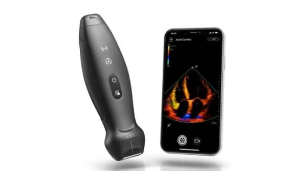 TE Air, Sistem Ultrasonografi Nirkabel Pertama dari Mindray yang Dapat Digenggam