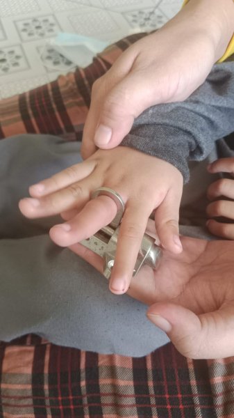 Petugas Damkar Evakuasi Anak Yang Jarinya Terjepit Lubang Jendela