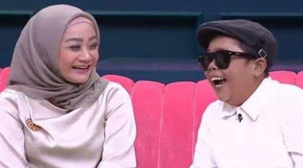 Adul Bantah Sakit Glaukoma hingga Buta, Awal Mula Isu Beredar Gegara Pandji Pragiwaksono