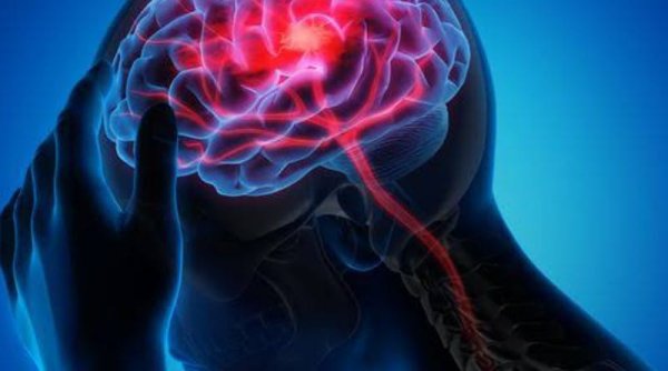 Peningkatan Risiko Stroke Akibat Kemampuan Mental Rendah di Masa Remaja