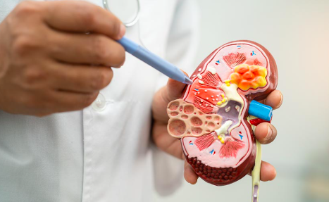 Dokter Urologi: Rebusan Daun Bisa Beracun bagi Ginjal jika Dikonsumsi Sembarangan