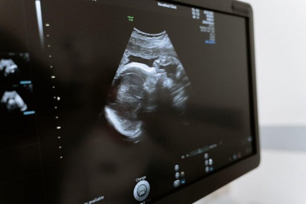 Kemenkes Tindak Dokter Obgyn Garut, Dugaan Pelecehan Saat USG Diusut