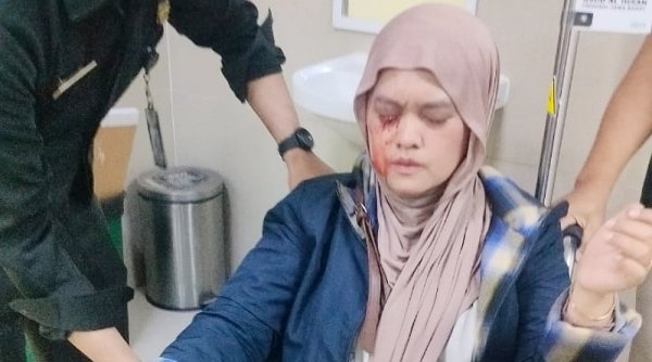 Hendak Silaturrahmi, Indra dan Wemmie Alami Insiden di Jalan Siliwangi Baleendah