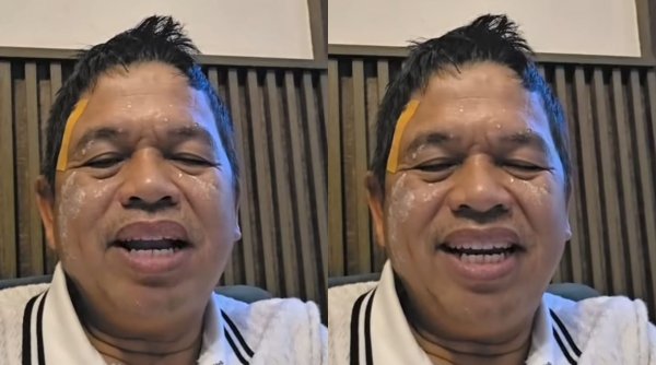 Dedi Mulyadi Akui Rasakan Kekecewaan Publik, Ingatkan Jangan Anarkis