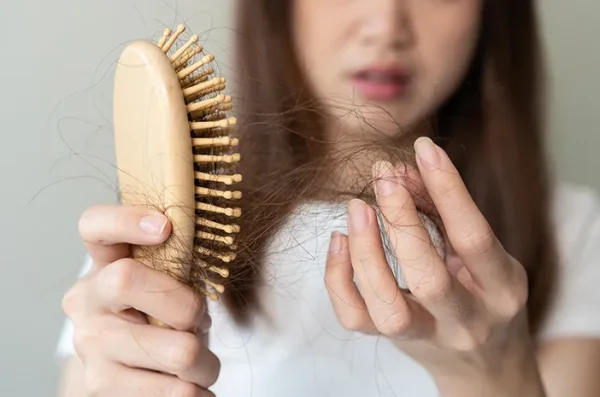 Studi: Minuman Manis dan Alkohol Bisa Tingkatkan Risiko Rambut Rontok