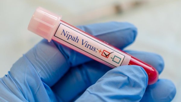 Perawat Tertular Virus Nipah Saat Bertugas, Satu Kritis di Rumah Sakit Bengal Barat